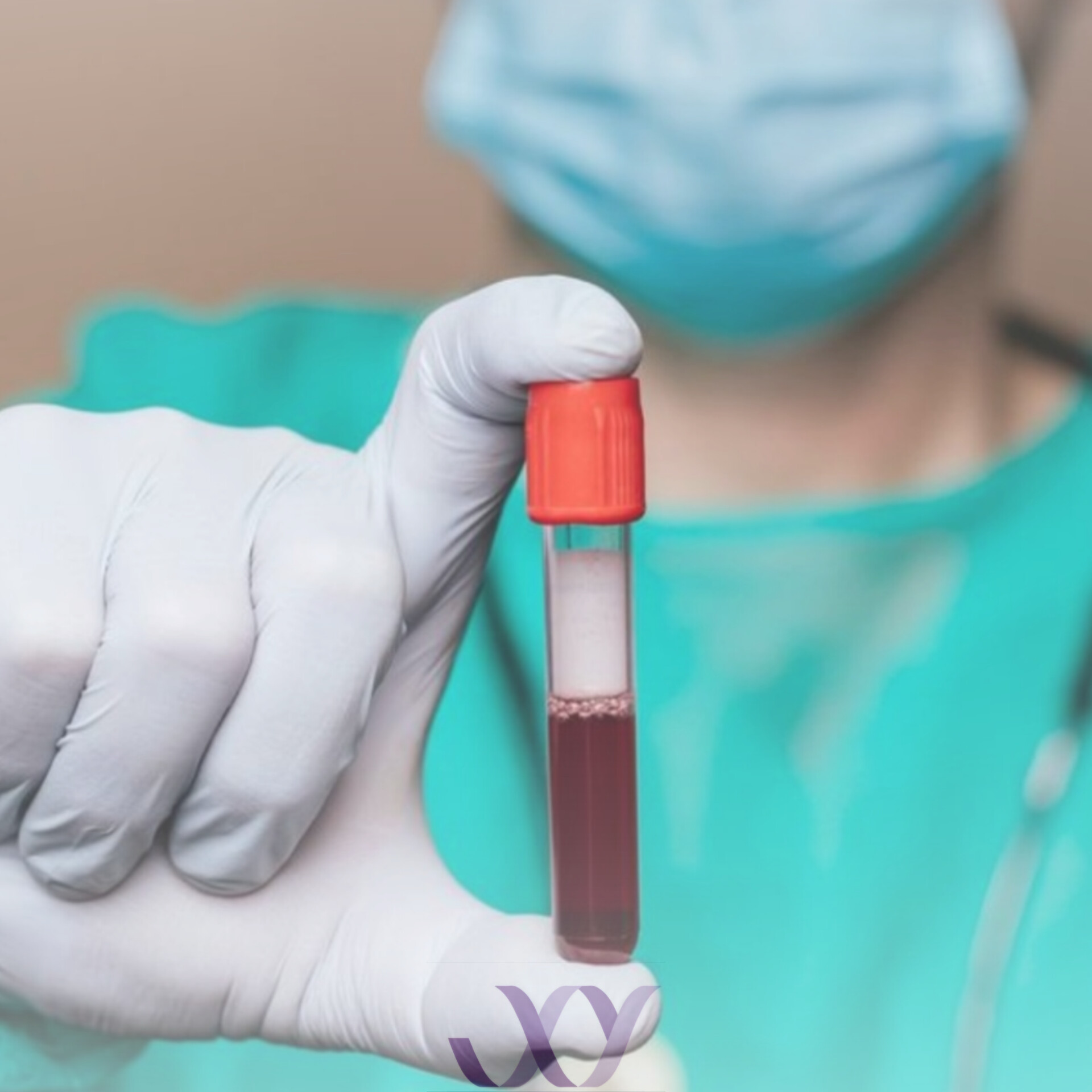 نمونه گیری آزمایش IGRA