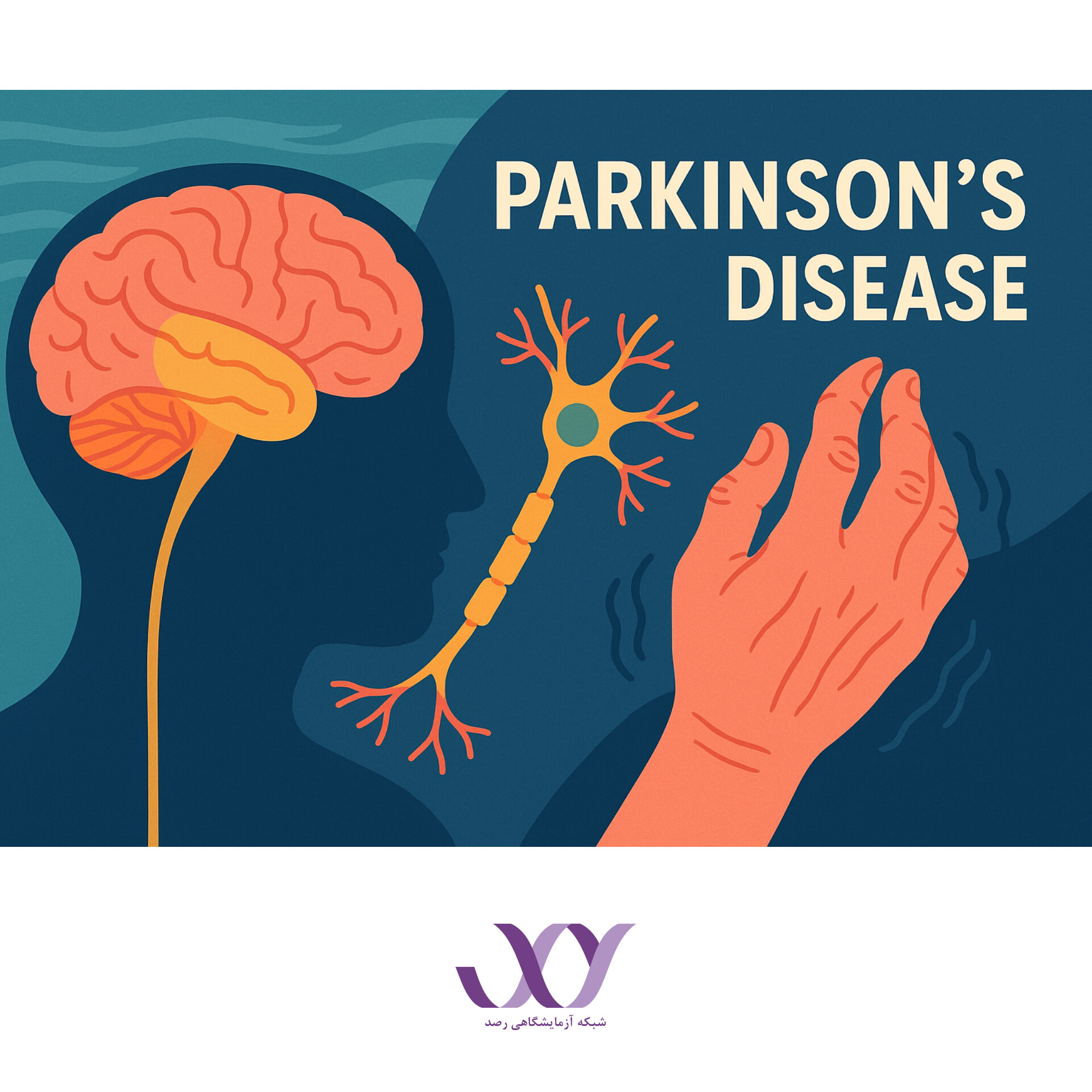 بیماری پارکینسون آزمایش مربوط به آن