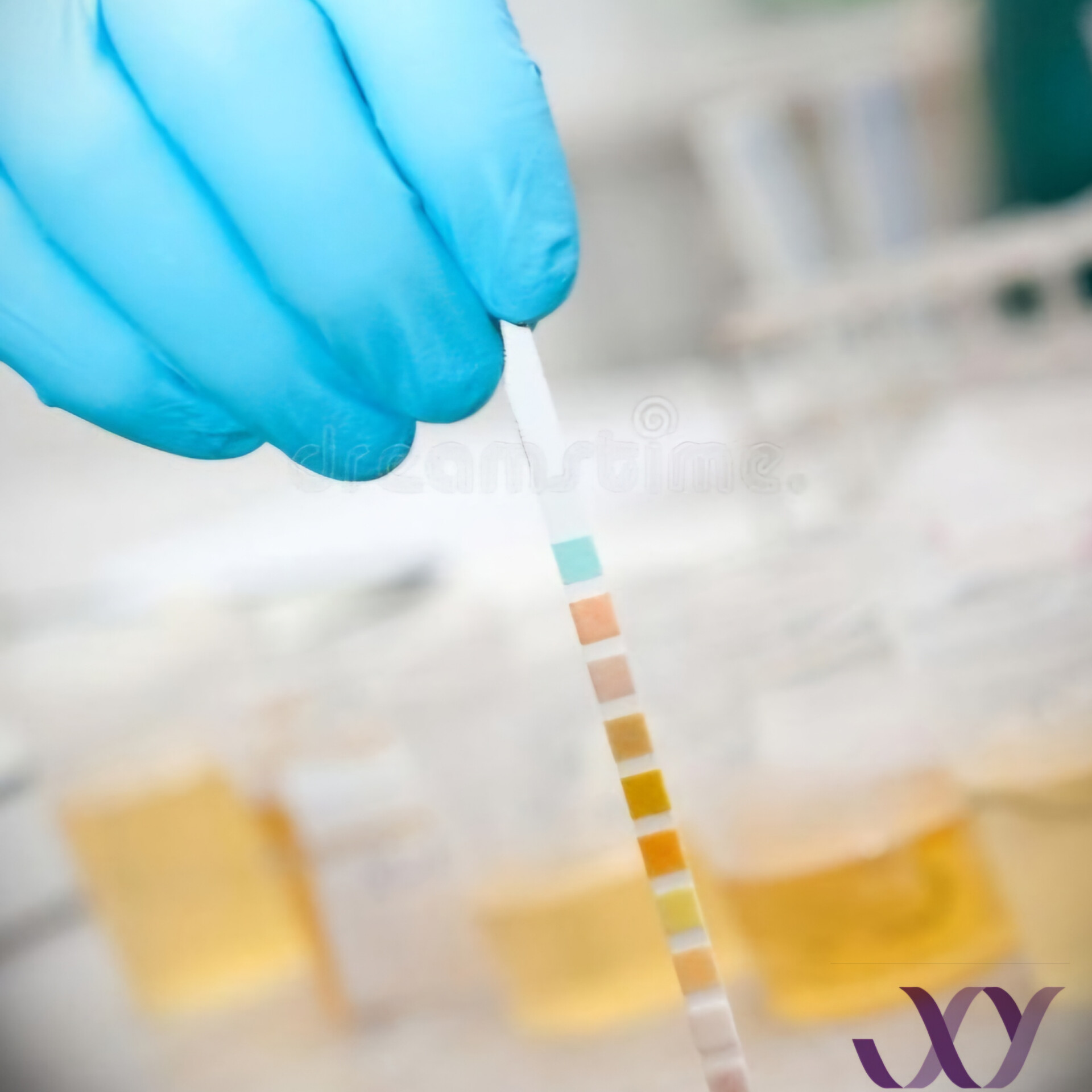 آزمایش کشت ادرار